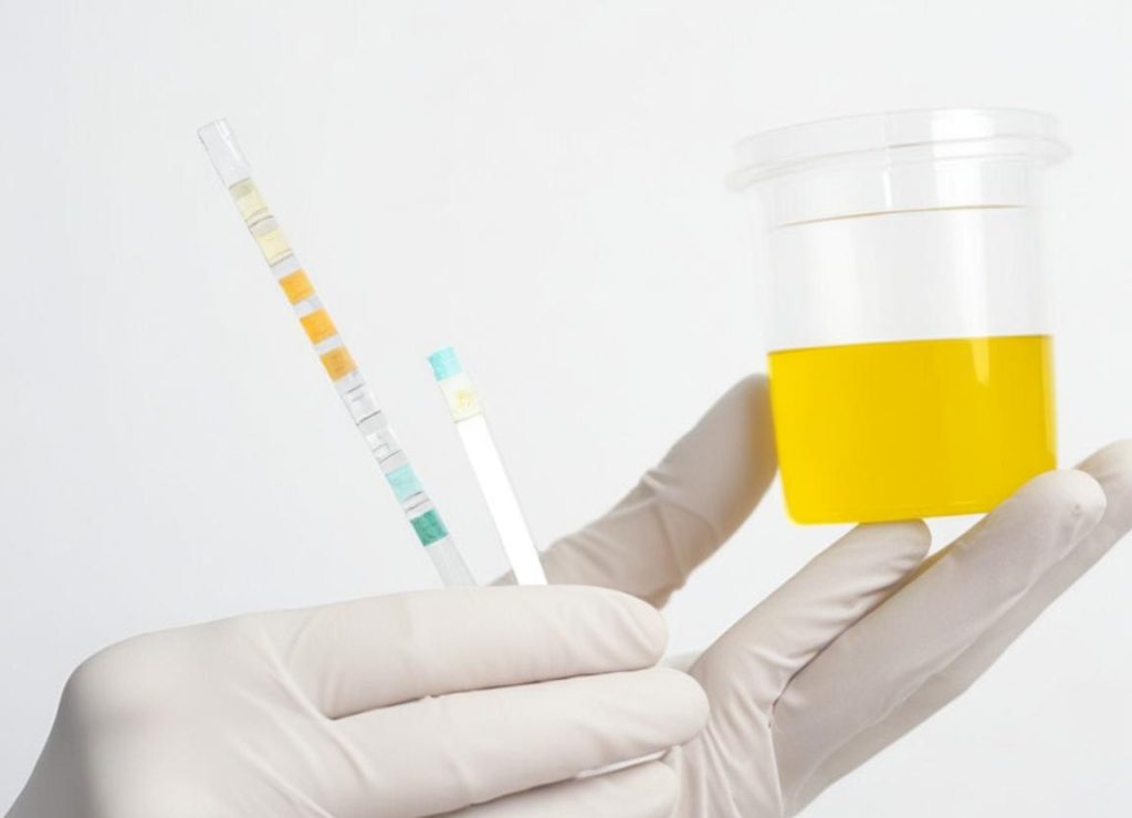 thca and thca in drug testing