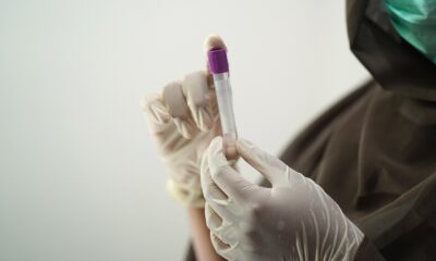 How to Beat a UA for Pot: Understanding Cannabis Drug Tests