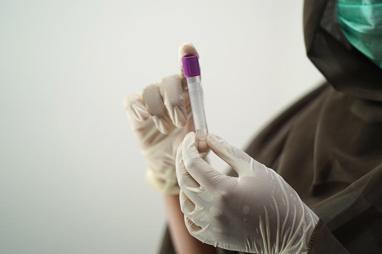 How to Beat a UA for Pot: Understanding Cannabis Drug Tests