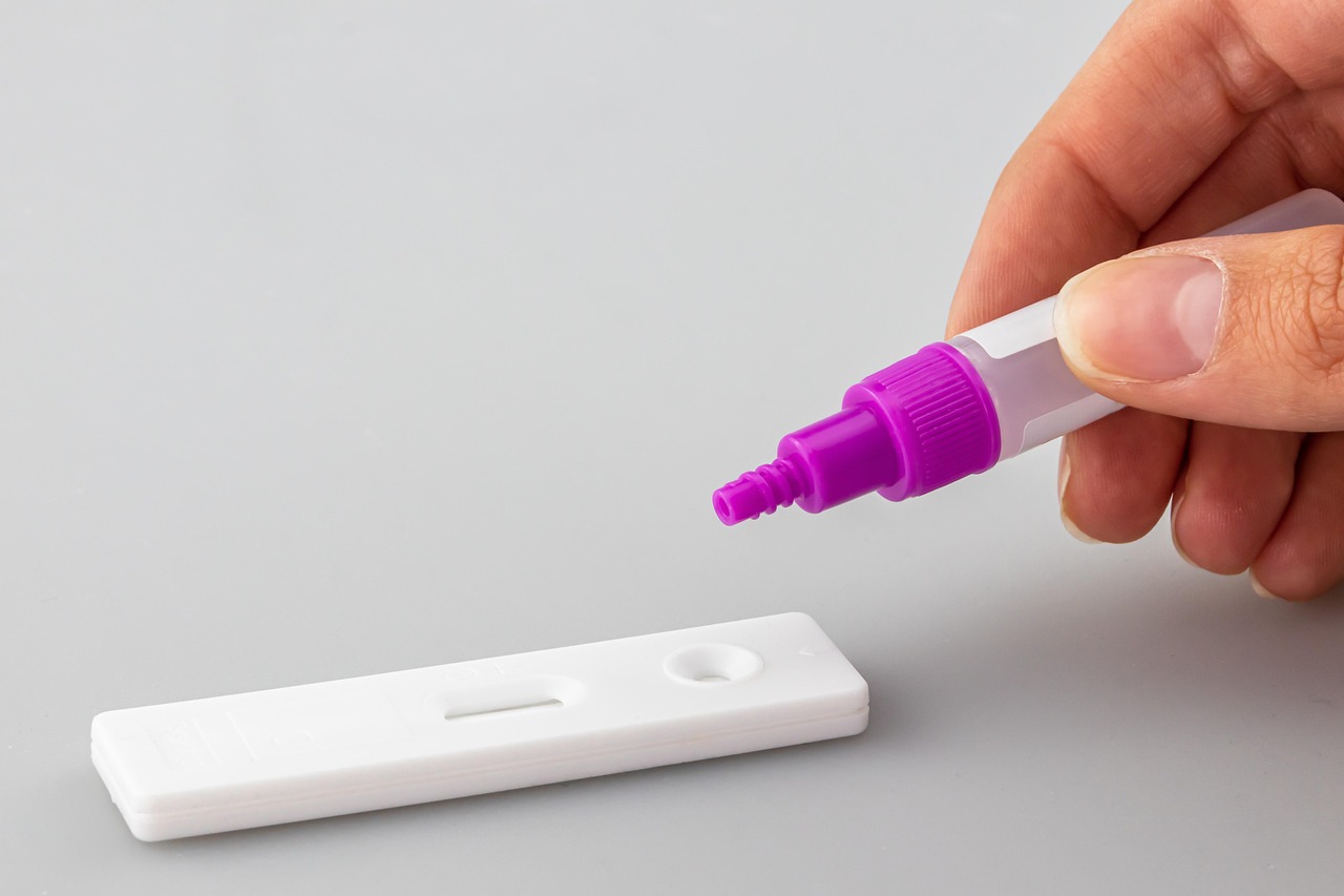 urine drug test cannabis